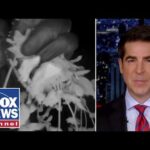 Watters: Things have gotten WEIRD
